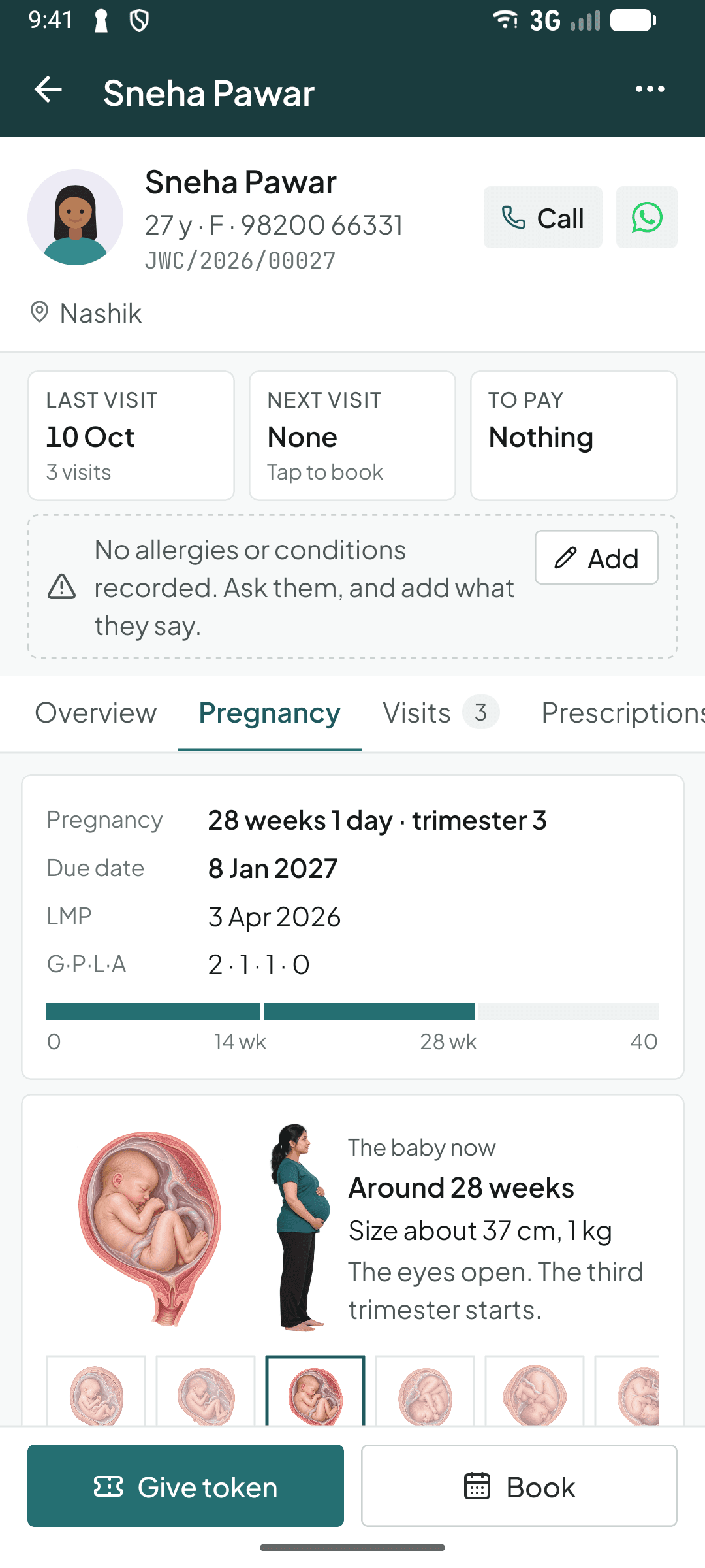 A pregnancy's weeks, due date and the baby's stage in the Curogrid Gynae phone app